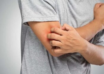 Lima Ciri Khas Gatal Akibat Diabetes